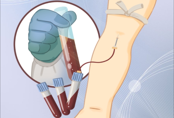 糖耐量检查可以判断是否有糖尿病