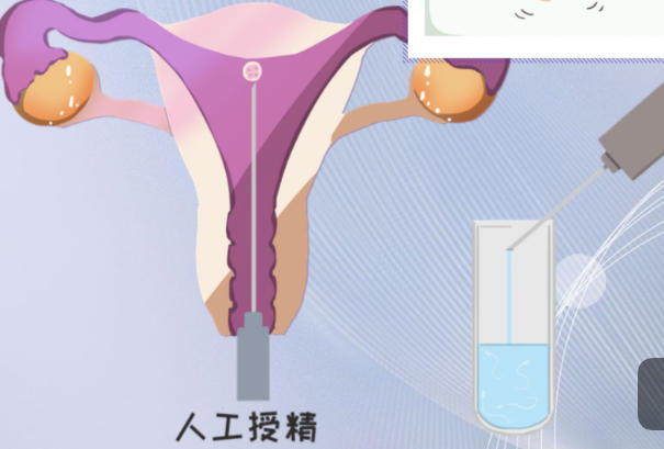 轻微出血是人工授精的着床信号