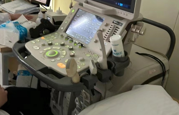 担心胎停就每周做B超