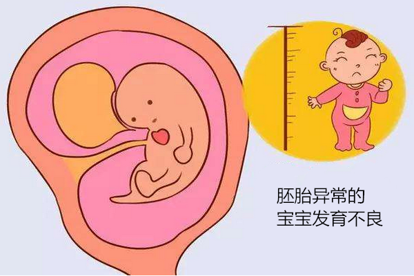 胚胎异常