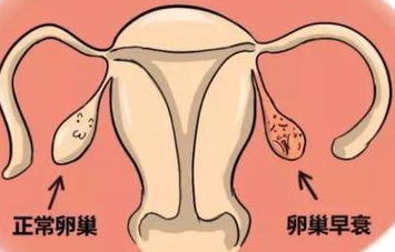 卵巢早衰早期症状/