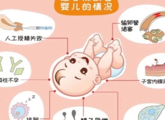 促排卵期间优质卵子比例试管婴儿，4个判断维度拿定主意