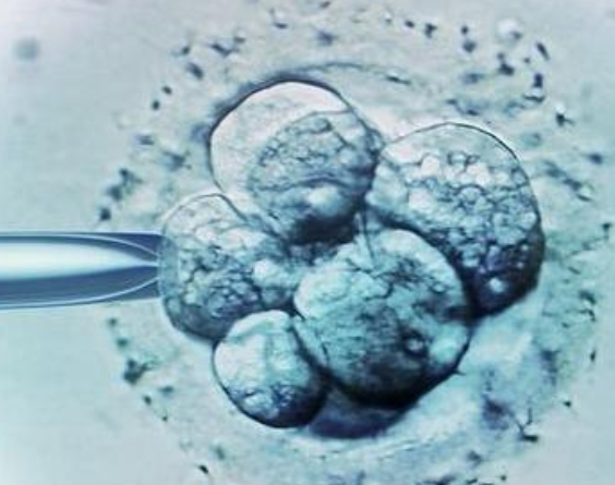3代试管体外卵子和精子结合步骤流程，每一步都很重要