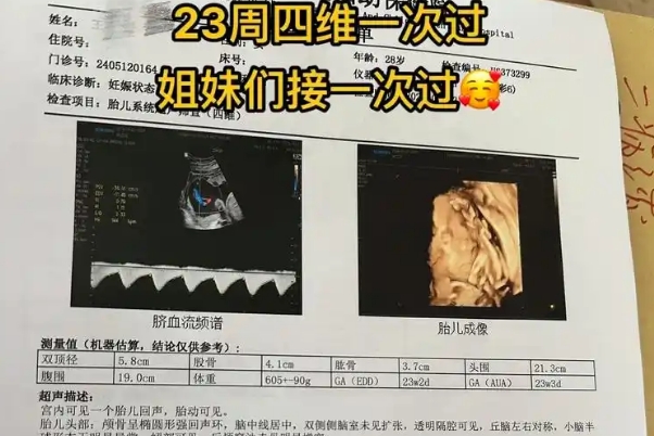 四维技术的局限性会影响胎儿性别的判断
