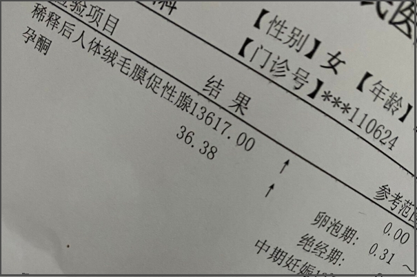 hcg翻倍不正常可能胚胎发育迟缓]