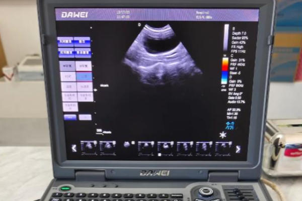 盆底肌检查和阴超疼痛感觉因人而异