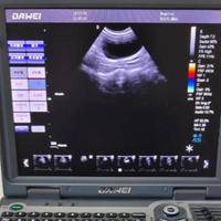 盆底肌检查和阴超哪个疼，一文了解真相减少焦虑