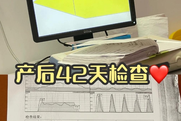 产后42天后复查不是智商税