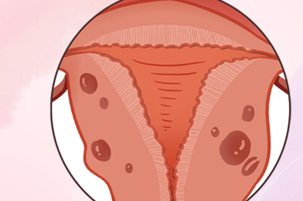 腺肌症怀孕4到6个月最危险?深入解析孕期风险与守护