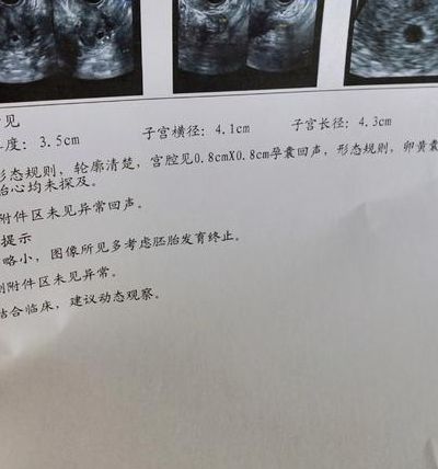 试管是怎么做的？从促排到移植，三步讲清完整流程