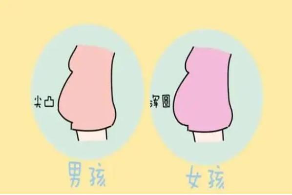 盘点22个最准预示怀男孩的征兆，肚型尖凸是男宝宝
