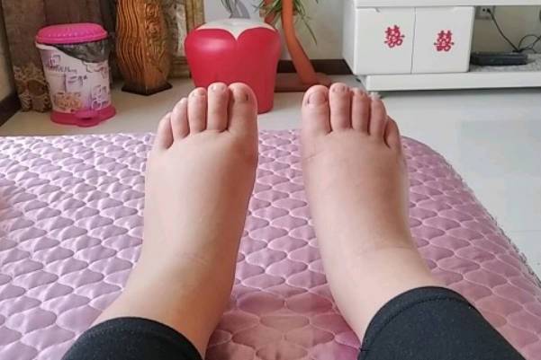 孕妇久坐久站会导致脚肿