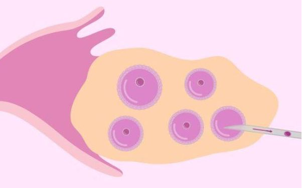 取卵后下个排卵期出血是月经还是异常?