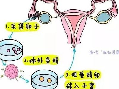 做试管婴儿的流程有多磨人？亲历者说实话