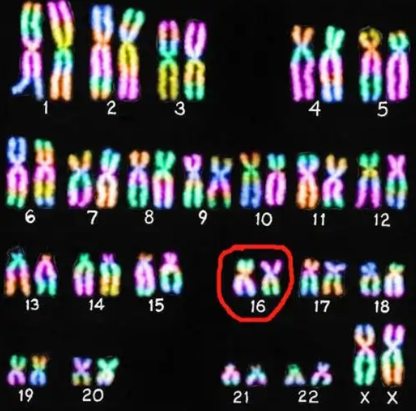 16号染色体异常生育方案