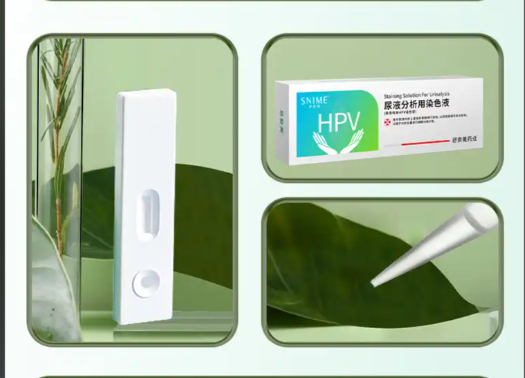 HPV自检盒准确率较高