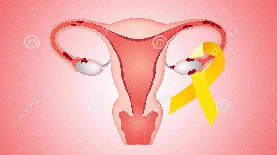 什么情况下会导致宫颈性不孕？