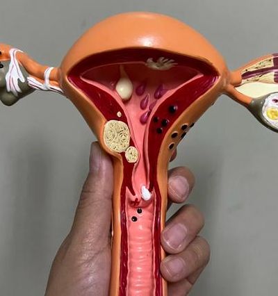 幼稚子宫可以生孩子吗？先看子宫体积和内膜条件