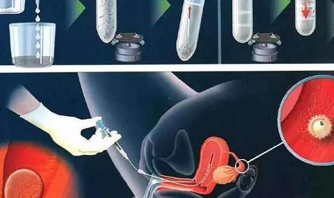 试管失败后多久能进行第二次试管？答案可能和你想象的不一样