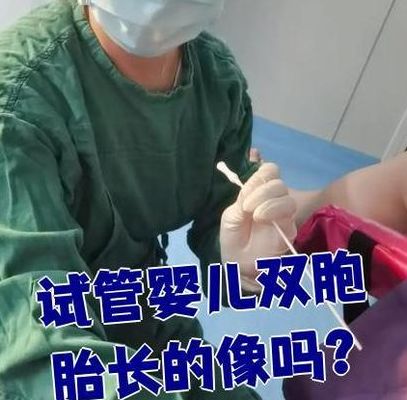 试管婴儿可以选择吗双胎吗？生殖咨询师说清合规边界
