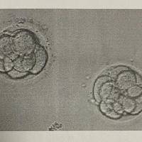 5细胞2级的胚胎能鲜胚移植吗？需结合胚胎发育规律综合判断