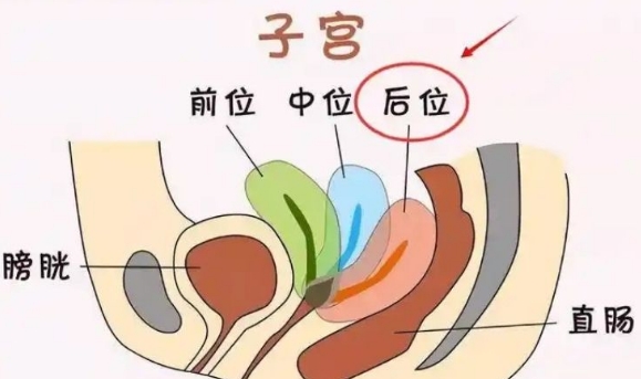 子宫后位怀孕都是男孩