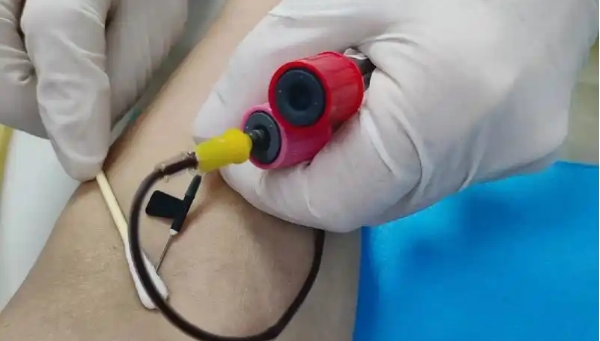 女性雄激素过高会导致不孕不育