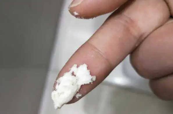 药渣颜色从白色或乳白色变成灰白色或淡黄色