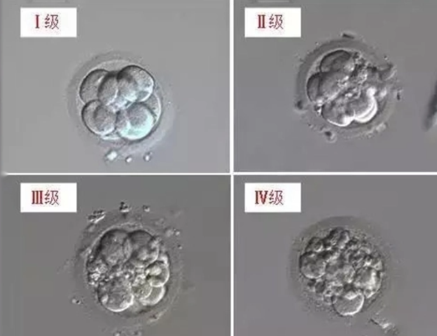 3代试管胚胎级别划分有标准，从对照表中一看就知哪个发育好