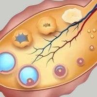 试管促排十六个卵泡，最终的胜利还取决于卵子的质量等