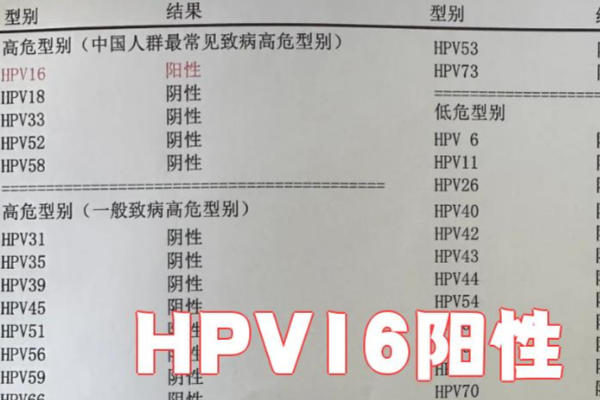 hpv16型阳性不等于患上宫颈癌