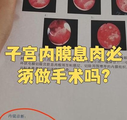 小的内膜息肉影响试管移植吗孕妇别急着取消周期