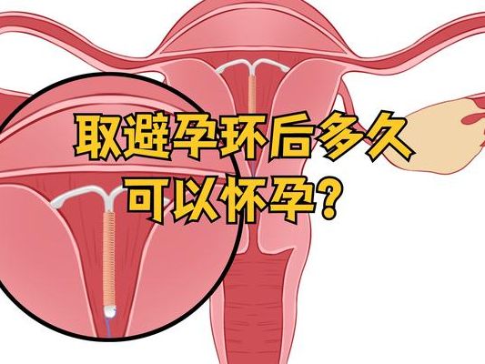怎么才能让妈妈不怀孕？中年女性避孕的3个关键步骤，很多子女都做错了