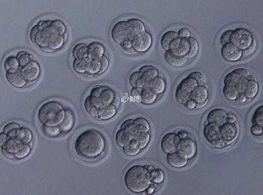 试管婴儿要多少钱呢?过来人帮你梳理5笔开销明细,价格一目了然
