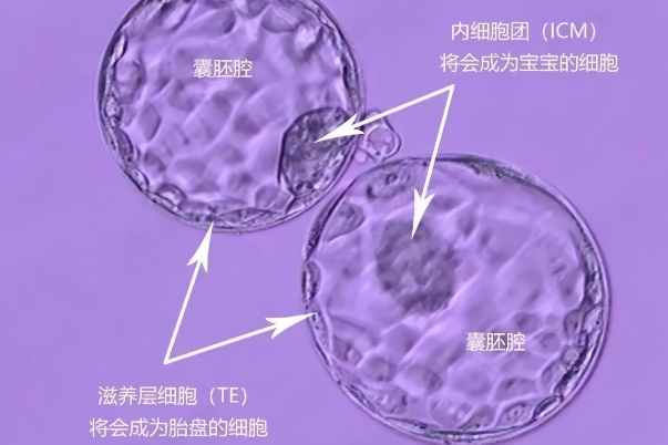 用药方案差异会影响取卵的结果