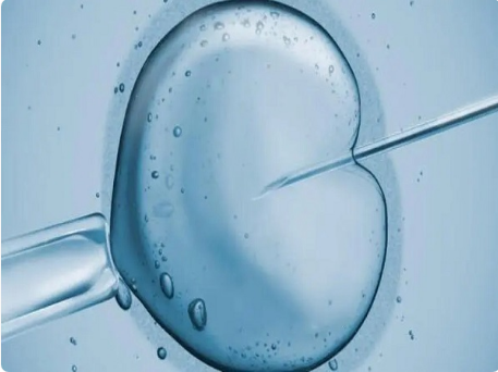 羊水穿刺可评估胎儿发育情况