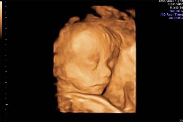 胎儿在发育中可能出现新的问题