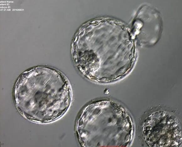 囊胚失败后再次移植可能怀孕