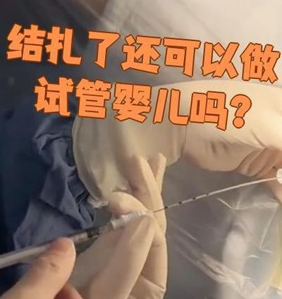 女人结扎后可以做试管婴儿吗？能，但先看这三点