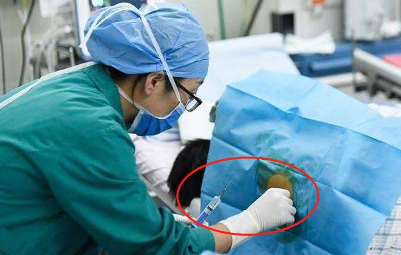 手术钳怎么拿剖腹产真比顺产轻松？看完这些“手术工具”，才知道啥叫为母则刚_https://www.jmylbn.com_新闻资讯_第5张