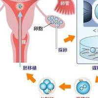 试管婴儿的全部步骤，我靠5个判断维度选对路