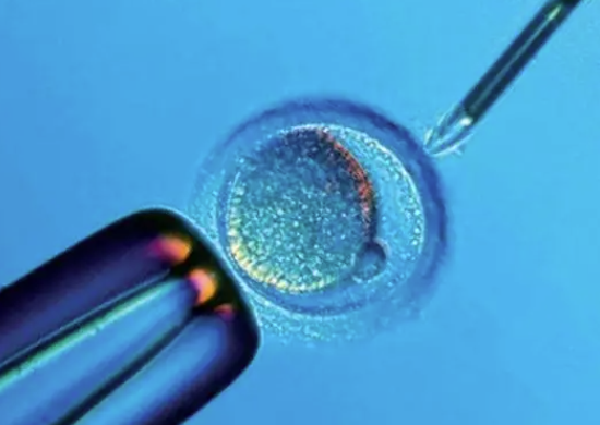 二代试管的单精子受精技术