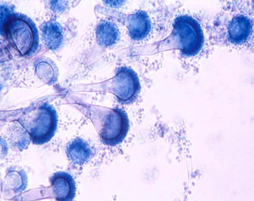 霉菌感染会影响胎儿健康