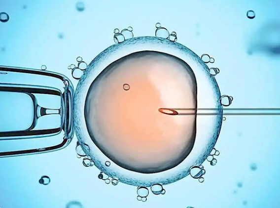 一代试管可移植鲜胚