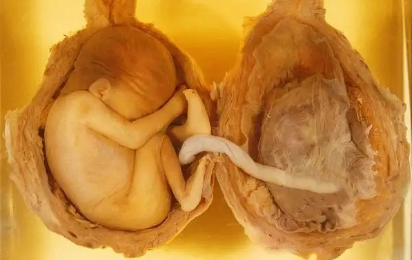 孕期减胎手术费用