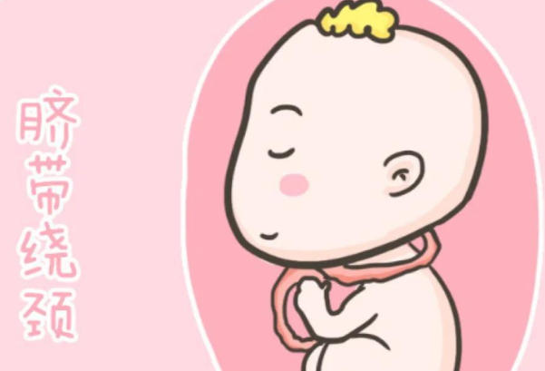 出生脐带缠脖子什么命?科学解读与民间说法的碰撞