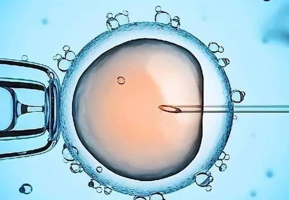 做第二代试管婴儿成功率高不高？决定因素根本不是_第几代_