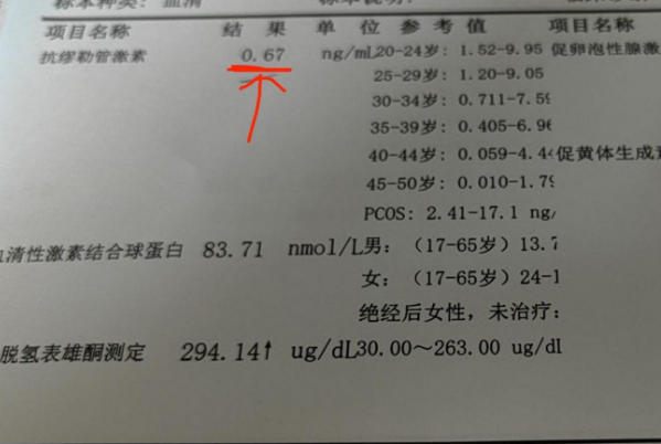 AMH复查时间因人而异