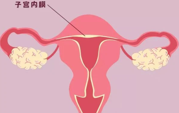 内膜息肉影响试管移植吗