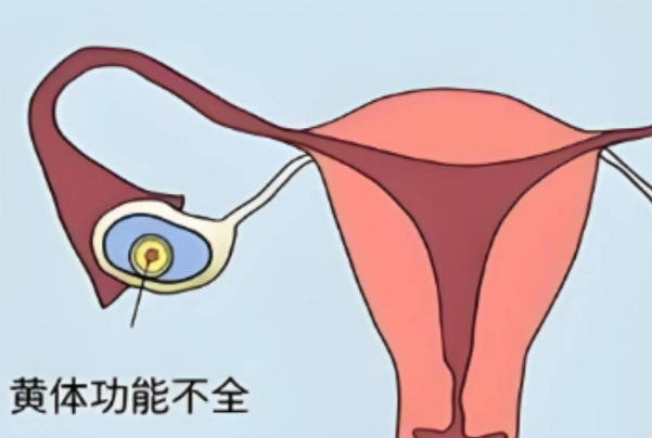 黄体期促排卵方案成功率因人而异